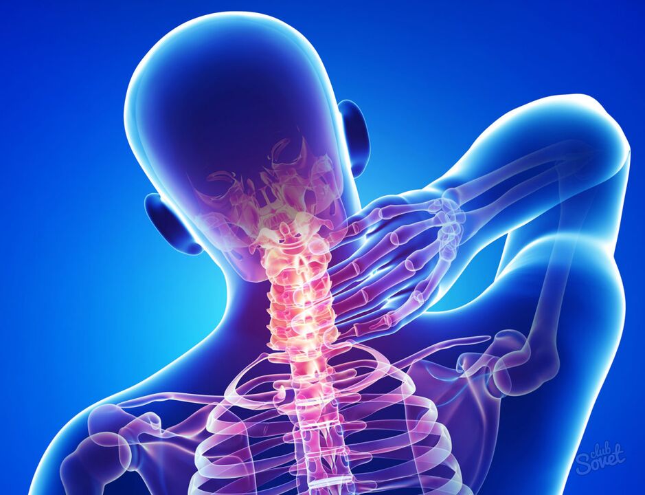 gimdos kaklelio osteochondrozė