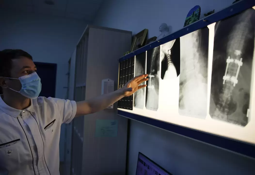 Gydytojai diagnozuoja gimdos kaklelio osteochondrozę instrumentiniais metodais, pavyzdžiui, rentgenografija
