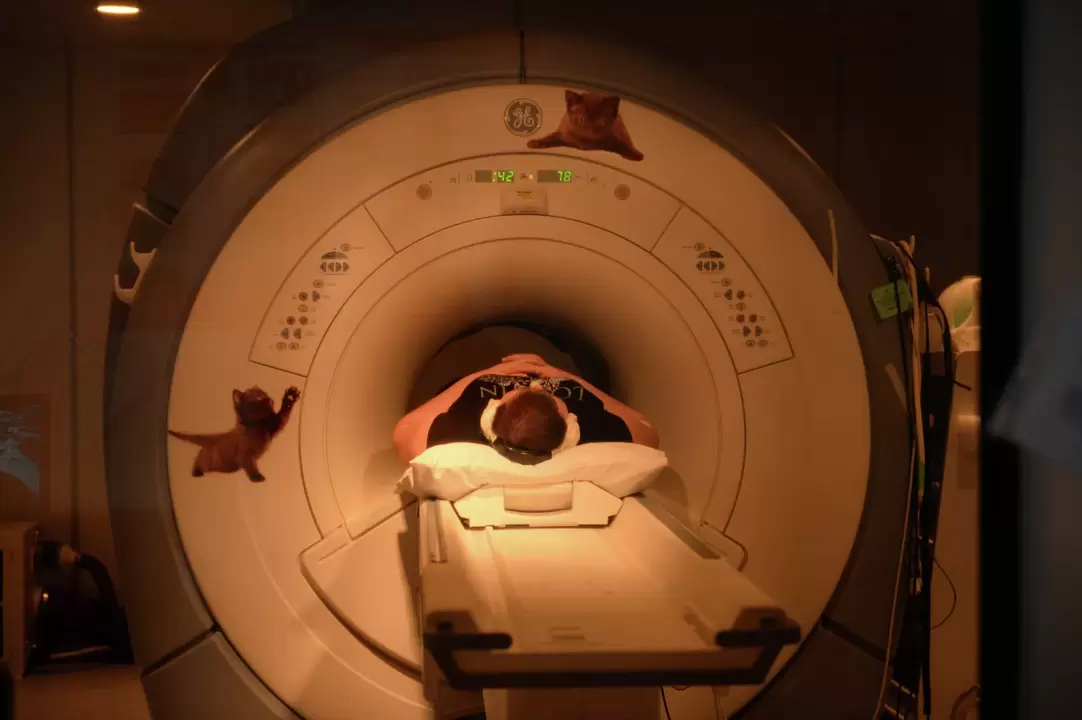 Magnetinio rezonanso tomografija yra efektyviausias gimdos kaklelio osteochondrozės diagnostikos metodas